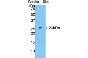 Western Blotting (WB) image for anti-Laminin, beta 2 (Laminin S) (LAMB2) (AA 1498-1716) antibody (ABIN1859603) (LAMB2 anticorps  (AA 1498-1716))