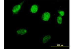 Immunofluorescence of purified MaxPab antibody to RAD51L3 on HeLa cell. (RAD51D anticorps  (AA 1-216))