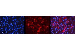 Rabbit Anti-TAPBP Antibody    Formalin Fixed Paraffin Embedded Tissue: Human Adult liver  Observed Staining: Cytoplasmic Primary Antibody Concentration: 1:600 Secondary Antibody: Donkey anti-Rabbit-Cy2/3 Secondary Antibody Concentration: 1:200 Magnification: 20X Exposure Time: 0.