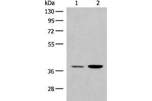 Western blot analysis of HEPG2 and K562 cell lysates using MRM1 Polyclonal Antibody at dilution of 1:400
