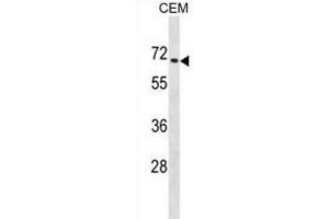 ZNF93 Antibody (N-term) (ABIN1882040 and ABIN2838921) western blot analysis in CEM cell line lysates (35 μg/lane). (ZNF93 anticorps  (N-Term))