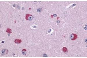 Immunohistochemical (Formalin/PFA-fixed paraffin-embedded sections) staining in human brain, neurons with TAAR1 polyclonal antibody . (TAAR1 anticorps  (2nd Extracellular Domain))