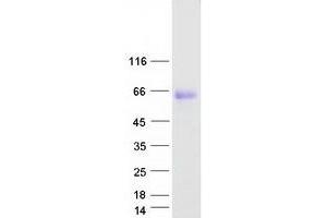 Validation with Western Blot