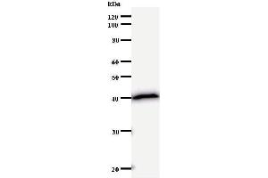 Western Blotting (WB) image for anti-SATB Homeobox 2 (SATB2) antibody (ABIN932998) (SATB2 anticorps)
