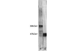 Western blot of whole rat cerebellum homogenate stained with ABIN1842266 in the left strip, at dilution of 1:20,000. (NEFL anticorps)