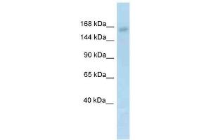 Western Blot showing Utx antibody used at a concentration of 1. (KDM6A anticorps  (N-Term))