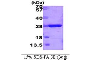 SDS-PAGE (SDS) image for Glutathione S-Transferase mu 1 (GSTM1) (AA 1-218) protein (ABIN666743) (GSTM1 Protein (AA 1-218))