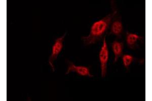 ABIN6274102 staining COLO205 by IF/ICC.