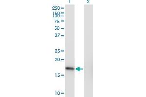 Western Blot analysis of SNX3 expression in transfected 293T cell line by SNX3 monoclonal antibody (M10), clone 3A9. (Sorting Nexin 3 anticorps  (AA 1-113))
