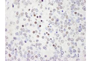 Immunohistochemistry (IHC) image for anti-Werner Helicase Interacting Protein 1 (WRNIP1) (AA 400-450) antibody (ABIN7449035)