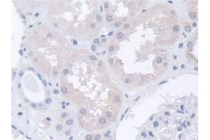 Detection of ARPC2 in Human Kidney Tissue using Polyclonal Antibody to Actin Related Protein 2/3 Complex Subunit 2 (ARPC2)