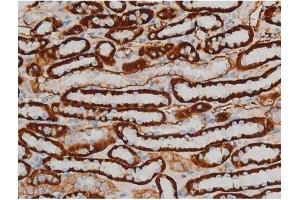 ABIN6267399 at 1/200 staining Rat kidney tissue sections by IHC-P. (CREB1 anticorps  (pSer142))