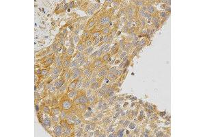 Immunohistochemistry (IHC) image for anti-Protein Kinase C, epsilon (PRKCE) (AA 488-737) antibody (ABIN3022942)