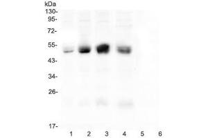 Western blot testing of CAR antibody and rat samples 1: pancreas (Coxsackie Adenovirus Receptor anticorps  (C-Term))