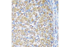 Immunohistochemistry of paraffin-embedded Rat ovary using  Rabbit pAb (ABIN7265696) at dilution of 1:100 (40x lens). (ALG5 anticorps  (AA 34-190))