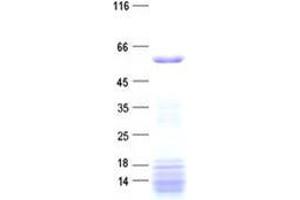 Validation with Western Blot
