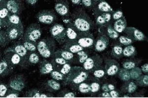 Immunofluorescence staining of human endothelial cells. (HDAC3 anticorps  (AA 309-425))
