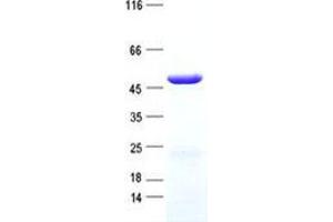 Validation with Western Blot (ZCCHC18 Protein (His tag))