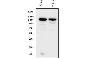 Western blot analysis of Integrin alpha V/ITGAV using anti-Integrin alpha V/ITGAV antibody (ABIN7602397).