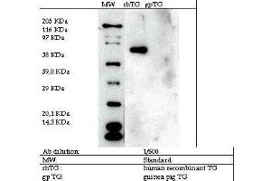 Image no. 2 for anti-Transglutaminase 2 (C Polypeptide, Protein-Glutamine-gamma-Glutamyltransferase) (TGM2) antibody (ABIN347018) (Transglutaminase 2 anticorps)