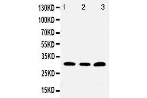 Anti-Tollip antibody, Western blotting Lane 1: PANC Cell Lysate Lane 2: HELA Cell Lysate Lane 3: U87 Cell Lysate (TOLLIP anticorps  (C-Term))