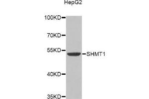 Western blot analysis of extracts of HepG2 cell line, using SHMT1 antibody. (SHMT1 anticorps)
