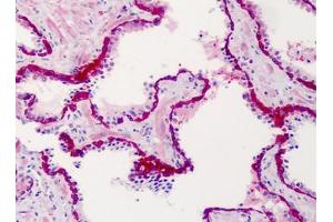 Human Prostate: Formalin-Fixed, Paraffin-Embedded (FFPE) (SLFN12 anticorps  (C-Term))