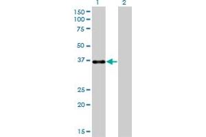 Western Blot analysis of PITX1 expression in transfected 293T cell line by PITX1 monoclonal antibody (M01), clone 5G4.