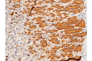 ABIN6267308 at 1/100 staining rat gastric tissue sections by IHC-P.