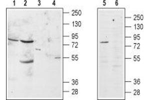 Western blot analysis of α1B-Adrenoceptor in rat brain (lanes 1 and 3), rat kidney (lanes 2 and 4) and GH3 cell line (lanes 5 and 6) lysates: - 1,2,5. (ADRA1B anticorps  (Extracellular, N-Term))