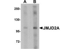 Western Blotting (WB) image for anti-Lysine (K)-Specific Demethylase 4A (KDM4A) (Middle Region) antibody (ABIN1030968) (KDM4A anticorps  (Middle Region))
