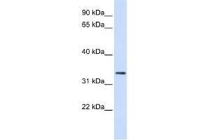 WB Suggested Anti-FBXO25 Antibody Titration:  0.