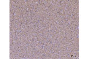 IHC analysis of WDR7 using anti-WDR7 antibody (ABIN7600939). (WDR7 anticorps  (AA 258-1292))