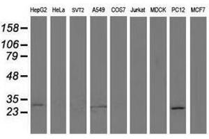 Image no. 6 for anti-Sepiapterin Reductase (SPR) antibody (ABIN1501111)