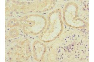 Immunohistochemistry of paraffin-embedded human kidney tissue using ABIN7150046 at dilution of 1:100 (ADAM19 anticorps  (AA 203-460))