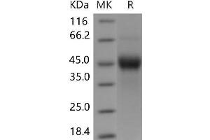 Western Blotting (WB) image for Tumor-Associated Calcium Signal Transducer 2 (TACSTD2) (Active) protein (His tag) (ABIN7198529)