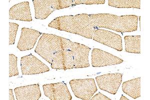 ABIN6260500 and ABIN6268739 at 1/100 staining Rat muscle tissue by IHC-P. (Cathepsin D anticorps  (C-Term))