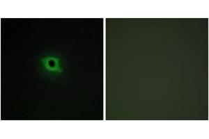 Immunofluorescence analysis of COS7 cells, using DGKK Antibody.
