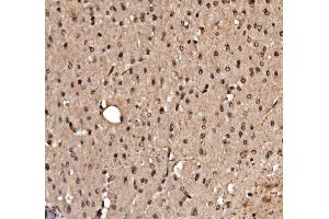 IHC analysis of KLF15 using anti-KLF15 antibody (ABIN7599269).