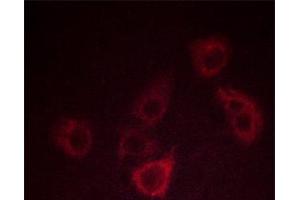 ABIN6267449 staining COS7 cells by ICC/IF.