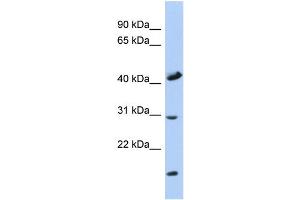 WB Suggested Anti-COX18 Antibody Titration: 0. (COX18 anticorps  (Middle Region))