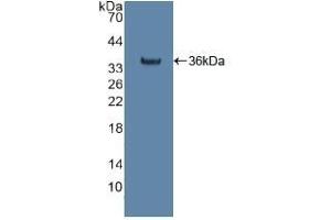 Detection of Recombinant citrate synthase, Human using Polyclonal Antibody to Citrate Synthase (CS) (CS anticorps  (AA 103-394))