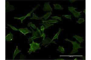 Immunofluorescence of monoclonal antibody to GUCY2D on HeLa cell.