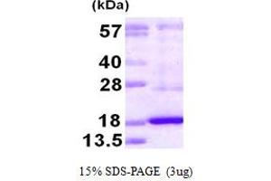 DUSP19 Protein (AA 65-217) (His tag)