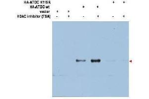 Western blot using  affinity purified anti-ATDC (Ac-K116) antibody shows detection of a 66 kDa band corresponding to over-expressed, acetylated lysine (K116) ATDC (arrowhead) in transfected 293T cells. (TRIM29 anticorps  (Internal Region))
