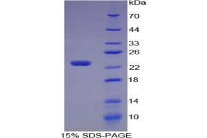 SDS-PAGE analysis of Human Stathmin 1 Protein. (Stathmin 1 Protein (STMN1))
