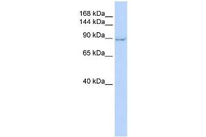 WB Suggested Anti-ZC3H7A Antibody Titration:  0. (ZC3H7A anticorps  (Middle Region))
