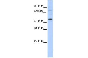WB Suggested Anti-LMX1A Antibody Titration:  5. (LMX1A anticorps  (C-Term))
