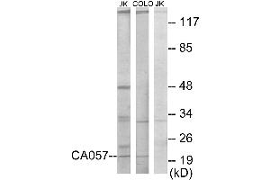 Western blot analysis of extracts from Jurkat cells and COLO205 cells, using CA057 antibody. (C1orf57 anticorps)