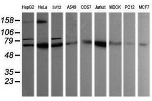 Image no. 2 for anti-SEC14 and Spectrin Domains 1 (SESTD1) antibody (ABIN1501067) (SESTD1 anticorps)